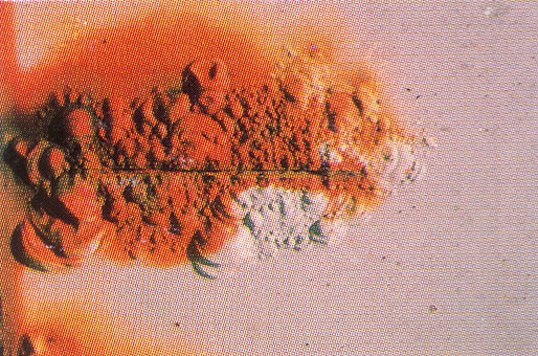 CD18